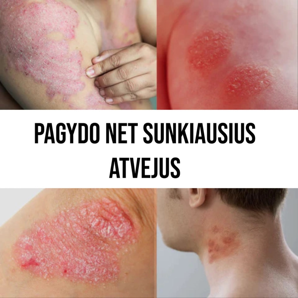 Serumas odos problemoms su natūraliais ingredientais