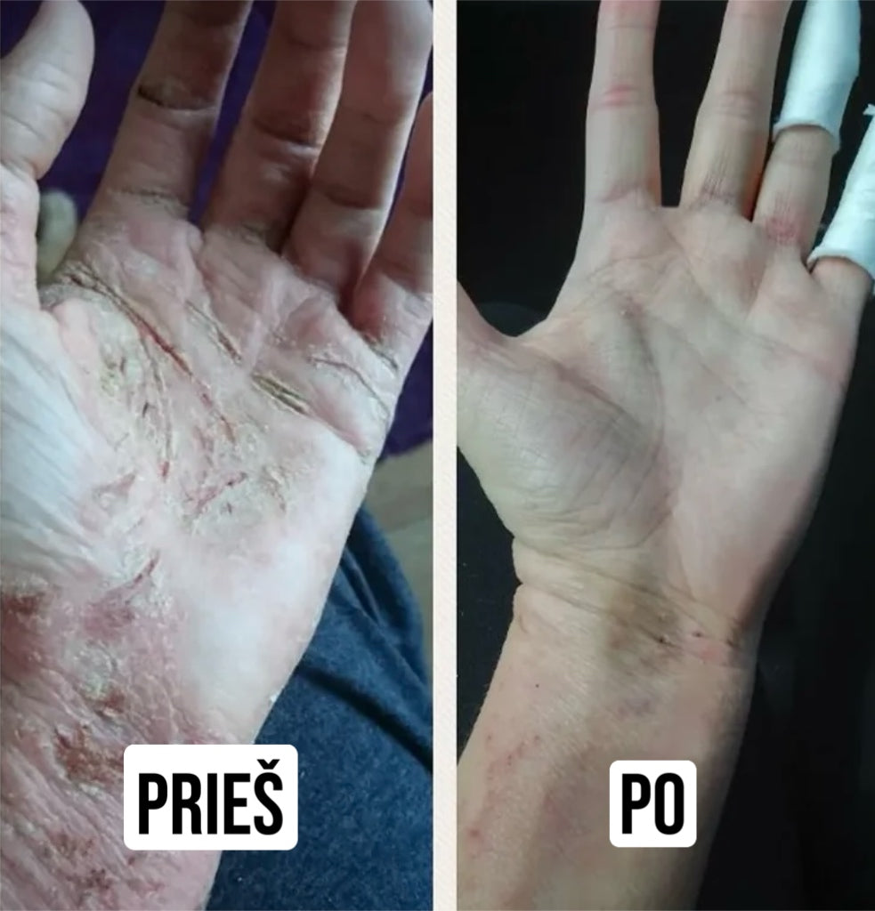 Serumas odos problemoms su natūraliais ingredientais