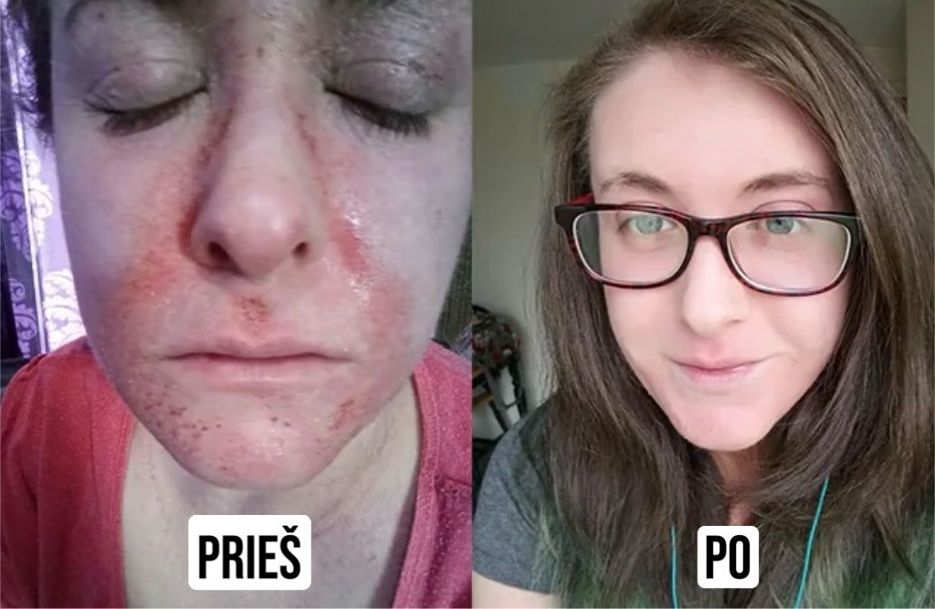 Serumas odos problemoms su natūraliais ingredientais