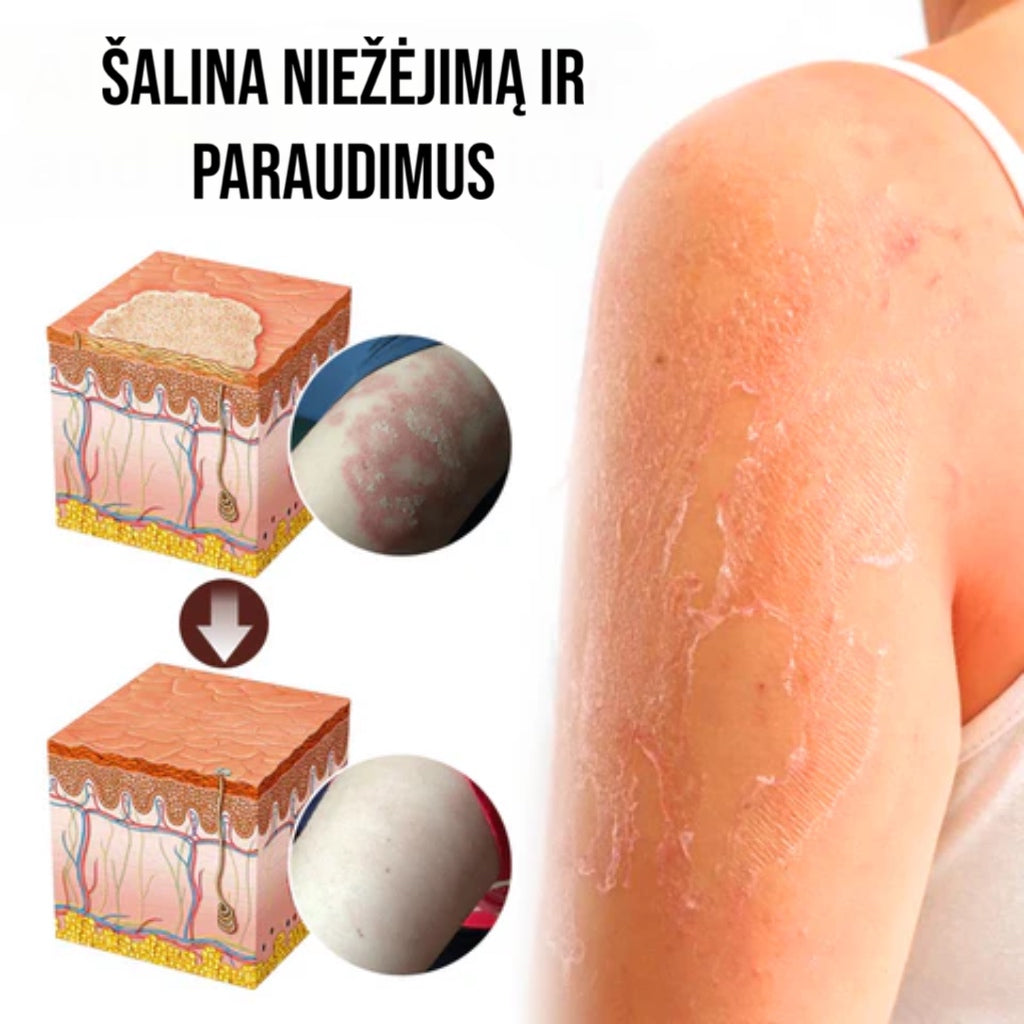 Serumas odos problemoms su natūraliais ingredientais