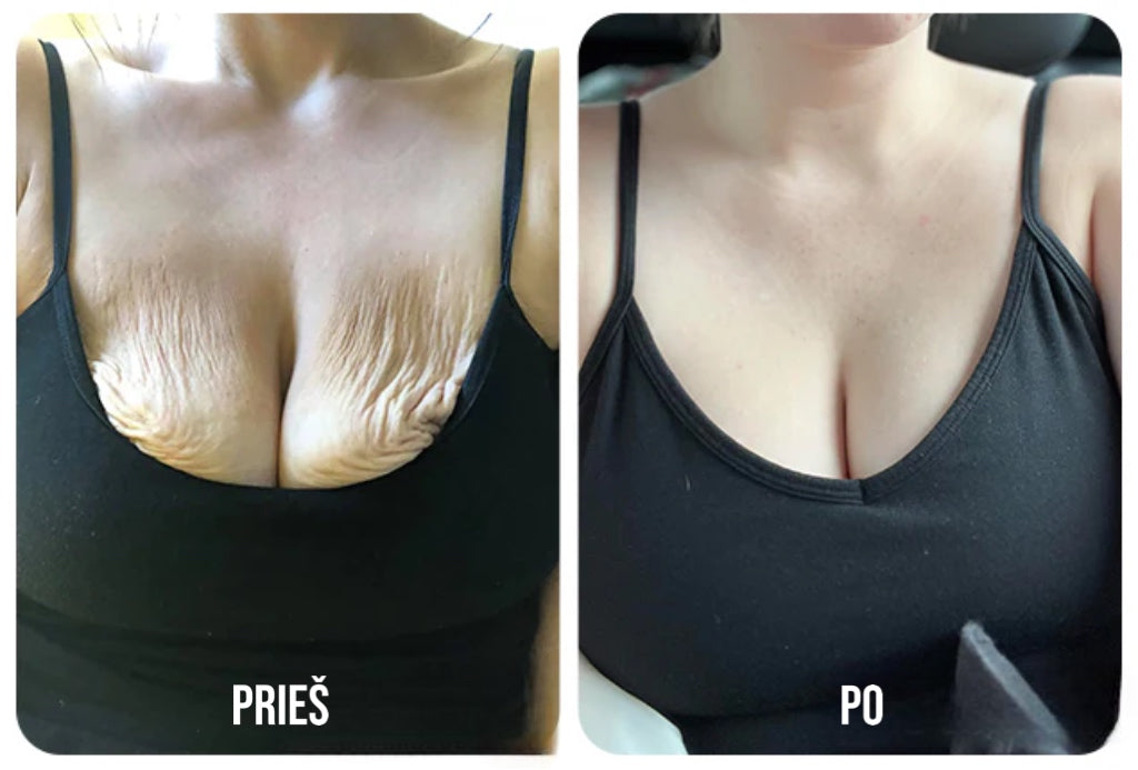 Stangrinamasis Raukšlių Mažinimo Kremas 100ml