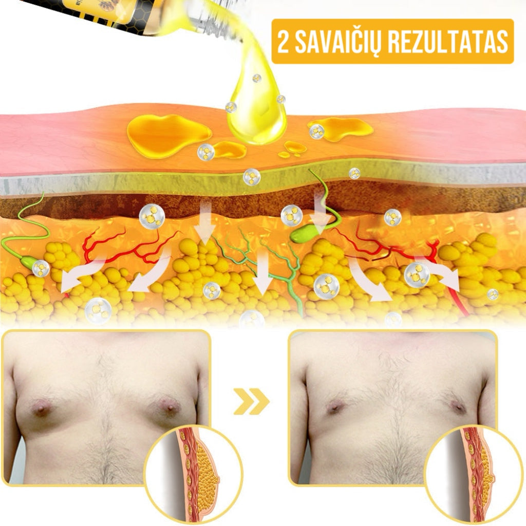 Bičių nuodų aliejus kūno kontūrams formuoti