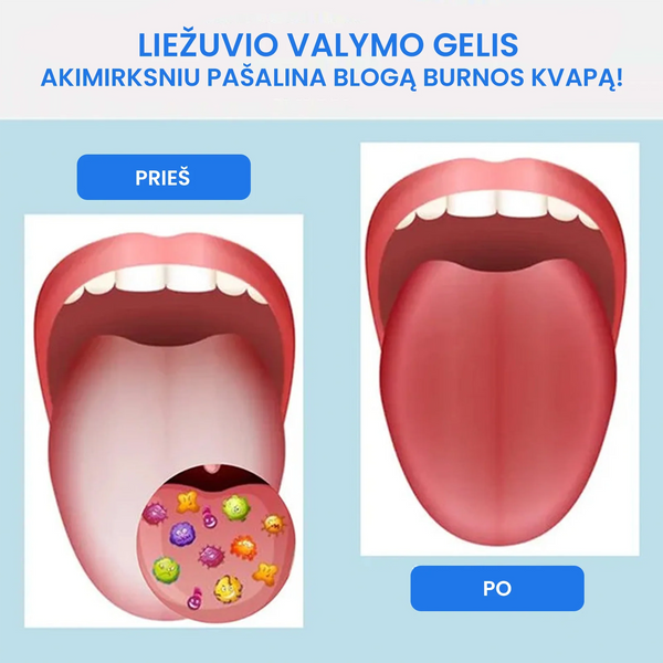 Liežuvio valymo rinkinys – bendras vaizdas
