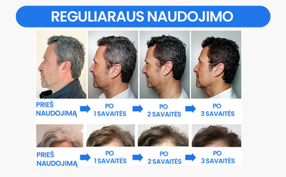 Muilas neutralizuojantis žilus plaukus – priekinė pusė