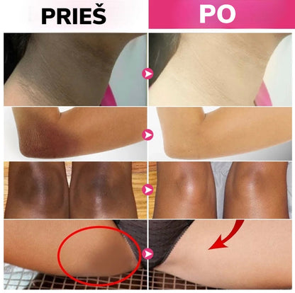 Kūno odos sričių priežiūros rezultatų koliažas