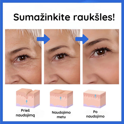 Veido serumo naudojimo raukšlių srityje iliustracija