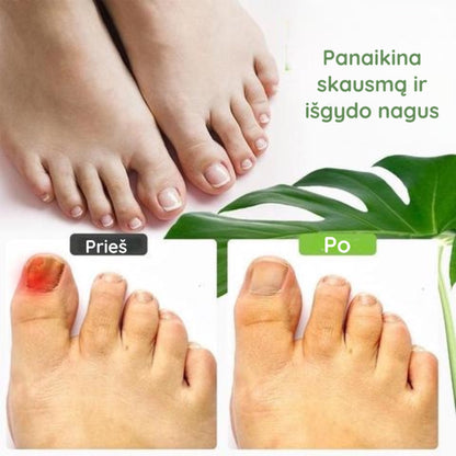 kojų nagų išvaizdos palyginimas