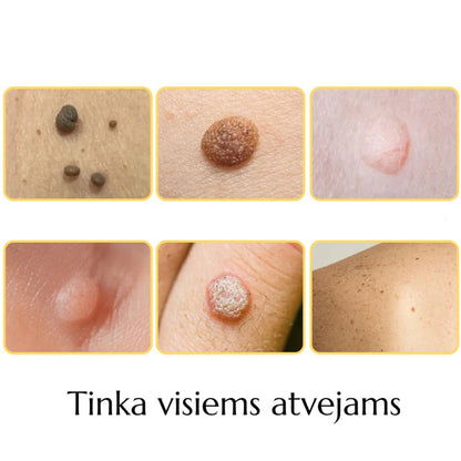 Bičių nuodų gydomasis purškalas