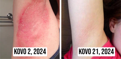 Odos Atgaivinimo Kremas